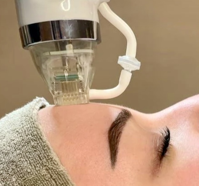 Radiofrequenz-Microneedling